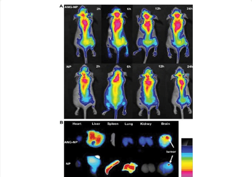 In Vivo Fluorescence Imaging Of Intracranial U87 Mg - U87 (850x596), Png Download