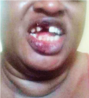 Tongue (788x410), Png Download