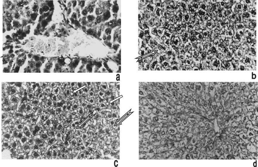 Control Animal Liver Showing Central Vein And Hepatocytes - Monochrome (850x552), Png Download