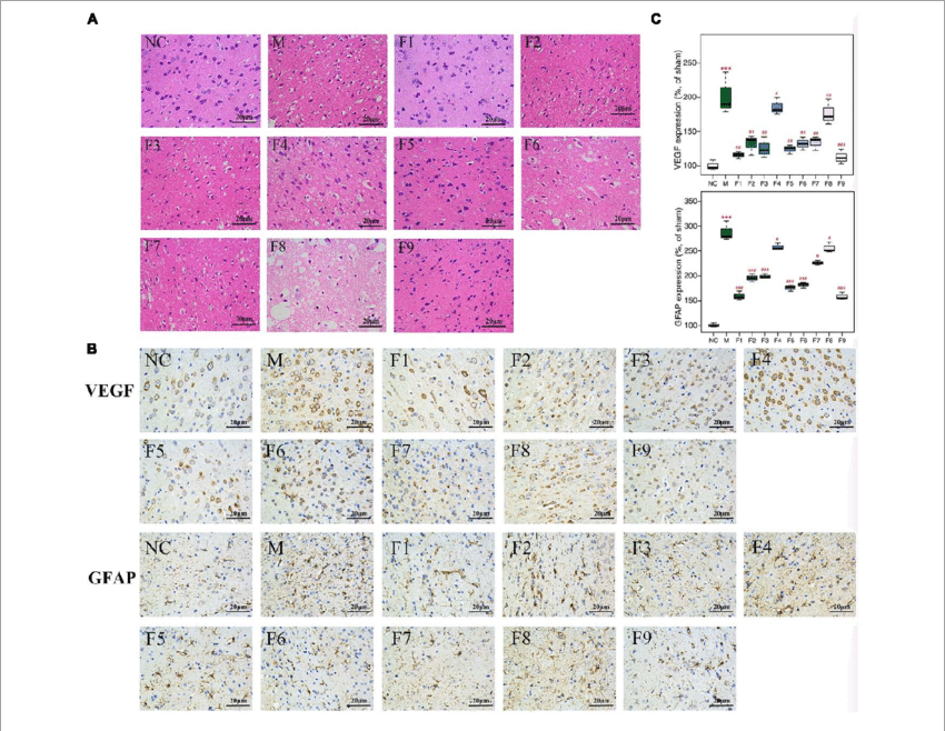 Histopathological Examination Of Brain Tissues By H&e - Art (850x658), Png Download