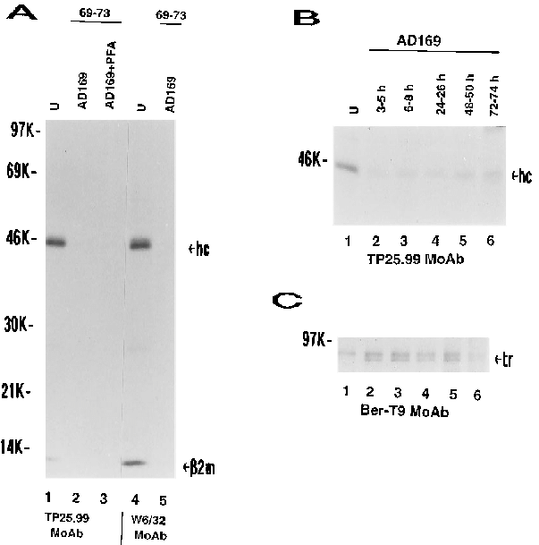 Expression Of Mhc Class I Heavy Chains In Hcmv Wild - Strain (618x633), Png Download