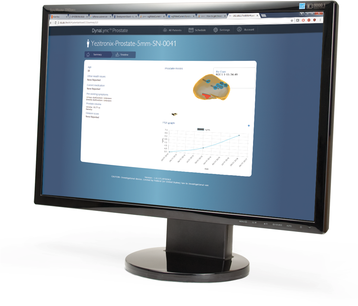 Dynalync Prostate Computer Screen - Computer Monitor (1186x1089), Png Download
