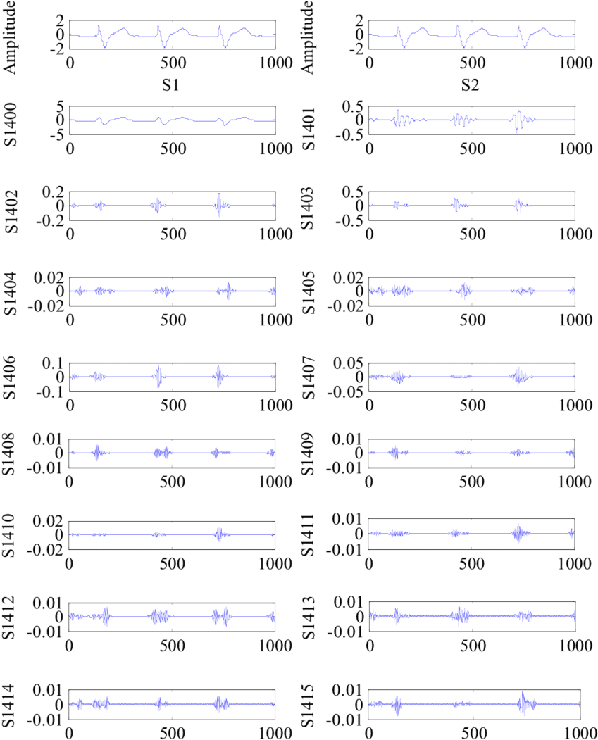 Results Of Ecg Signal Decomposition Using Wpd - Electric Blue (850x1057), Png Download
