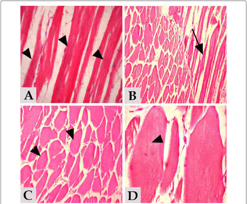2 And 3 Showing Normal, Intact Skeletal Muscle With - Muscle (850x702), Png Download