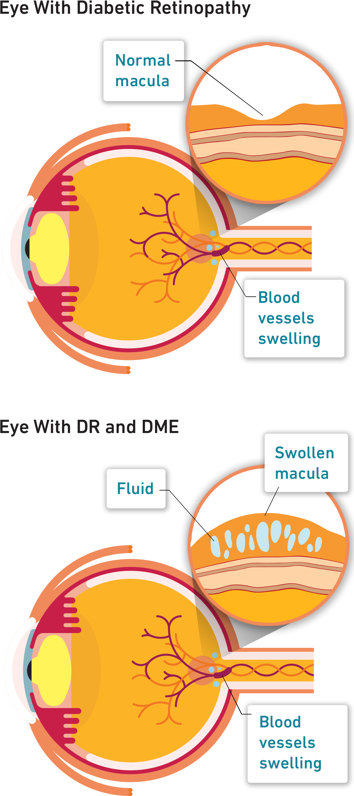 If You Have Diabetes And Are Experiencing Problems - Orange (1208x2784), Png Download