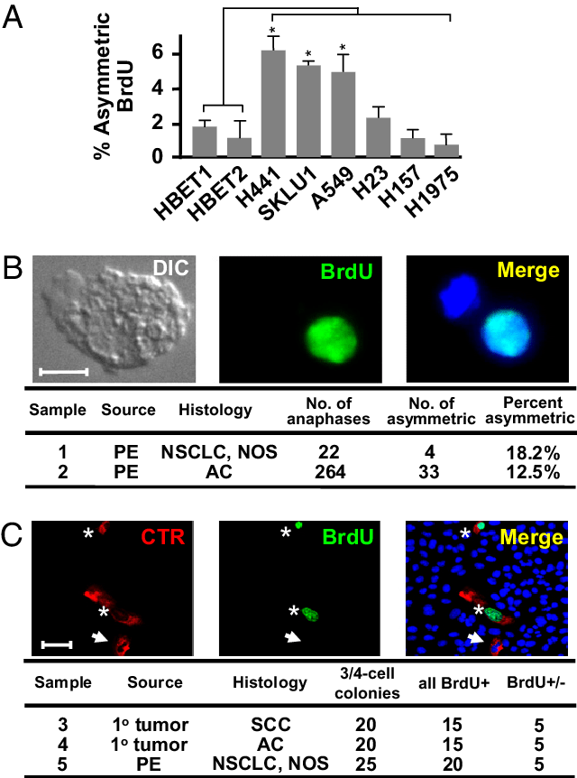 Template Dna Is Divided Asymmetrically In Several Human - Brdu And Asymmetric Division (640x862), Png Download
