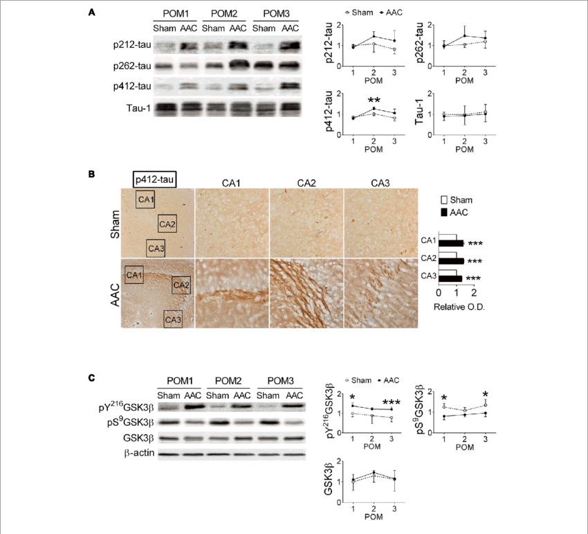 7 Month Old Pigs Were Given The Aac Or The Sham Operation, - Tau Protein (850x771), Png Download
