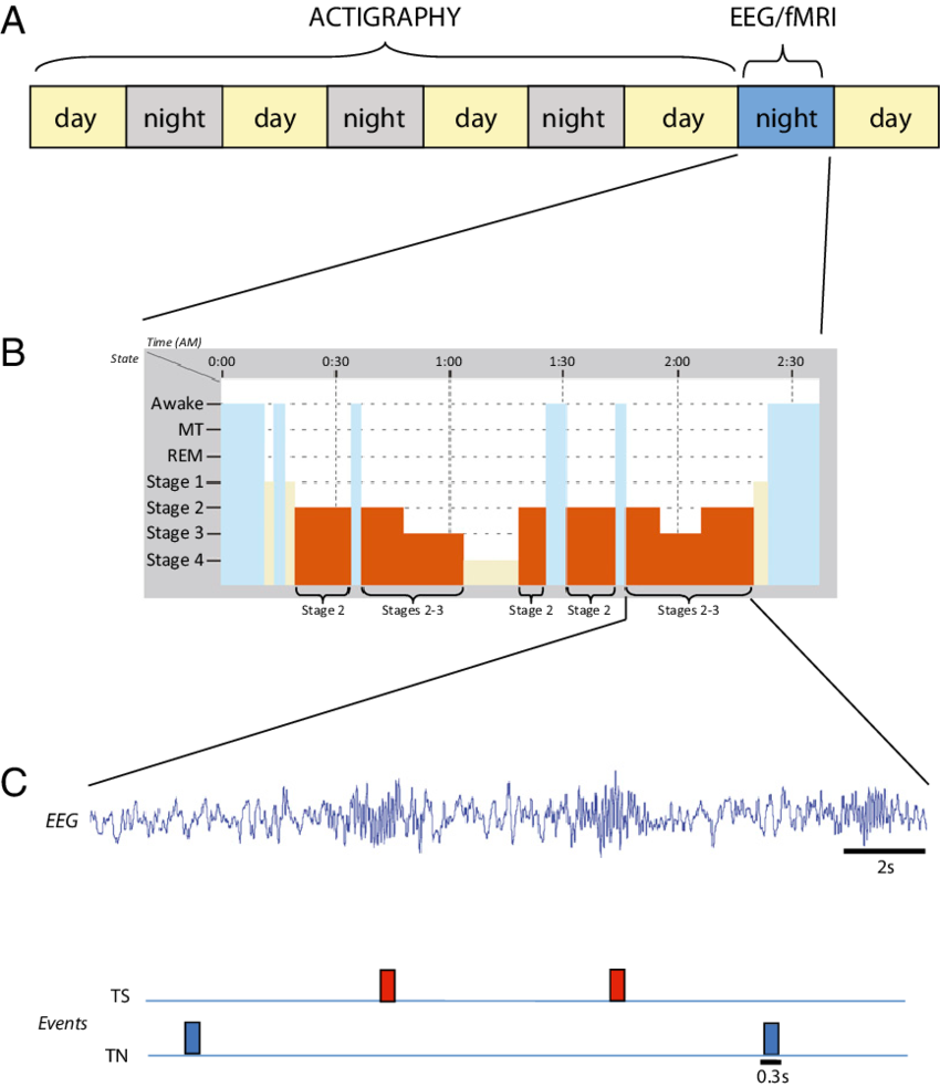 Volunteers Were Recorded With Eeg/fmri During The Experimental - Electroencephalography Functional Magnetic Resonance (850x983), Png Download