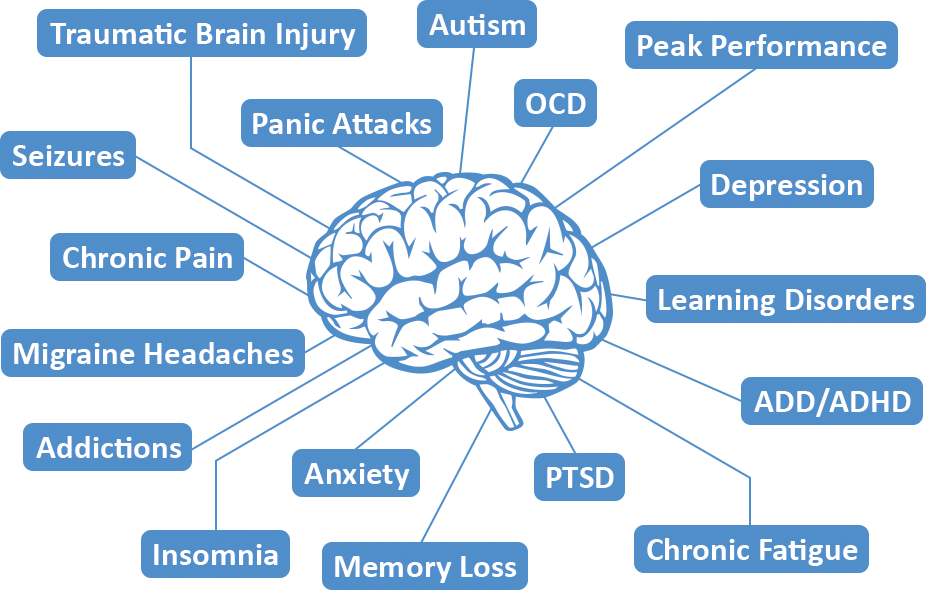 Brain - Neurofeedback Benefits (926x590), Png Download