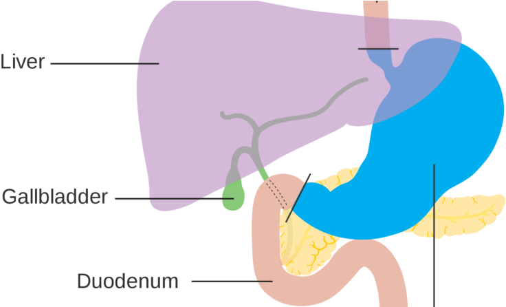 Facts About Stomach Cancer - Stomach Cancer (800x445), Png Download
