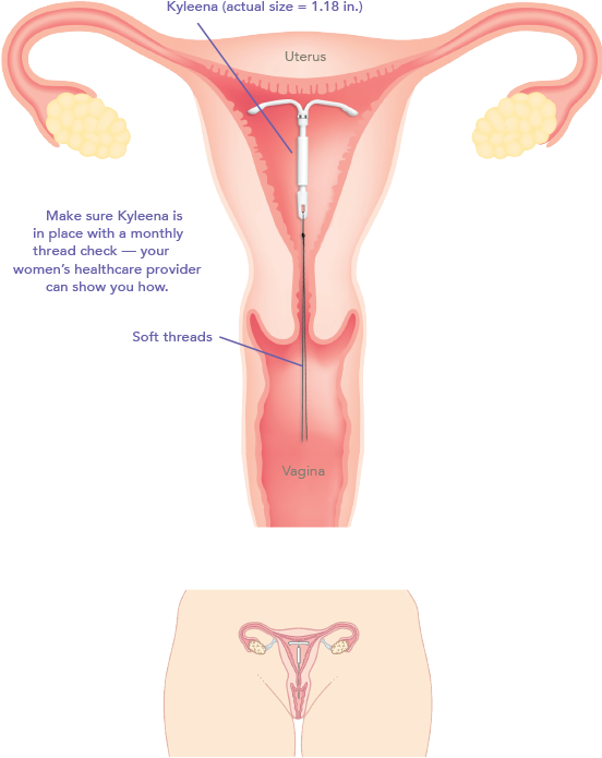You - Copper T Family Planning Method (561x793), Png Download