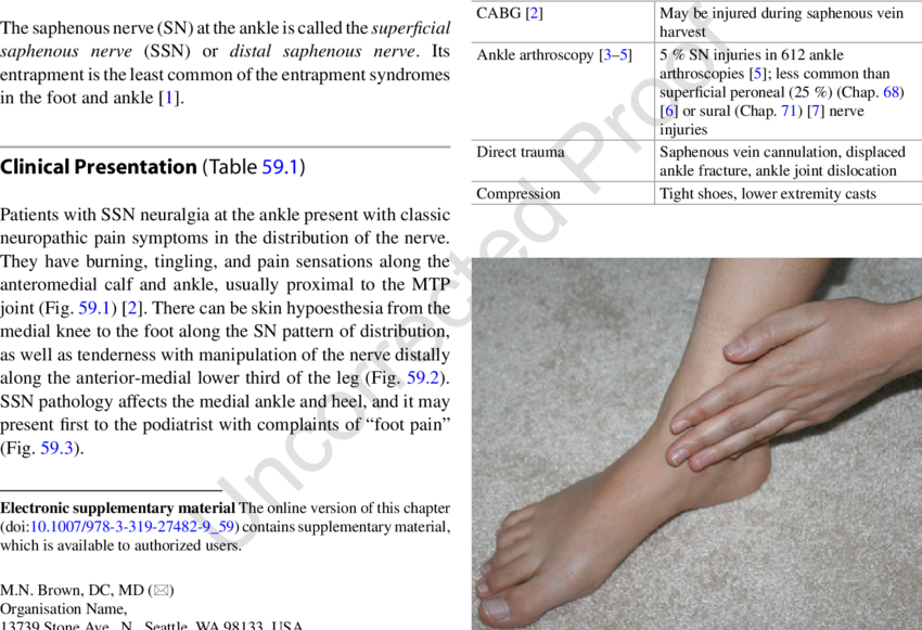 1 Patient's Pain Complaint From Distal Saphenous Nerve - Saphenous Nerve Pain Ankle (850x581), Png Download