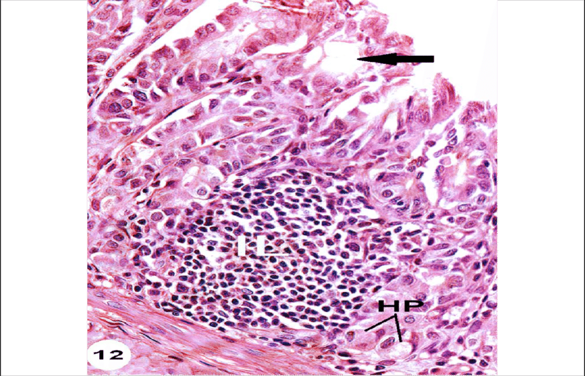 Cross Section Of Stomach Of Rat Treated With (850x547), Png Download