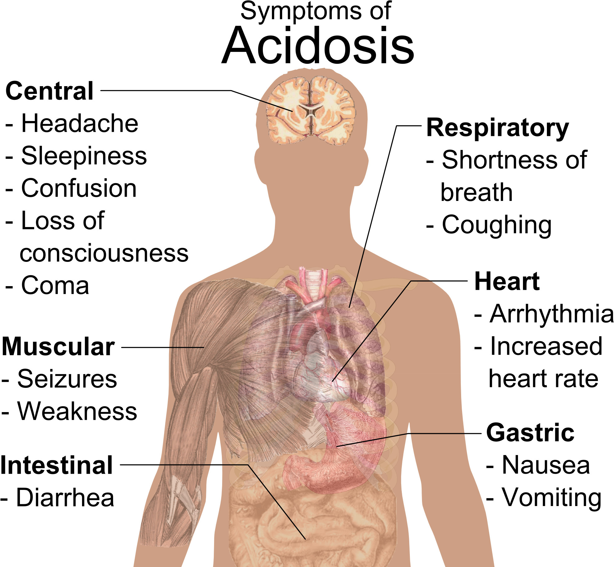 Symptoms Of Acidosis - Importance Of Ph In Daily Life (2006x1837), Png Download