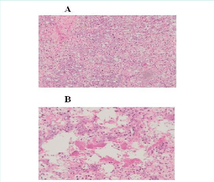 Histologic Assessment Of Post Mortem Lung Tissue - Staining (744x634), Png Download