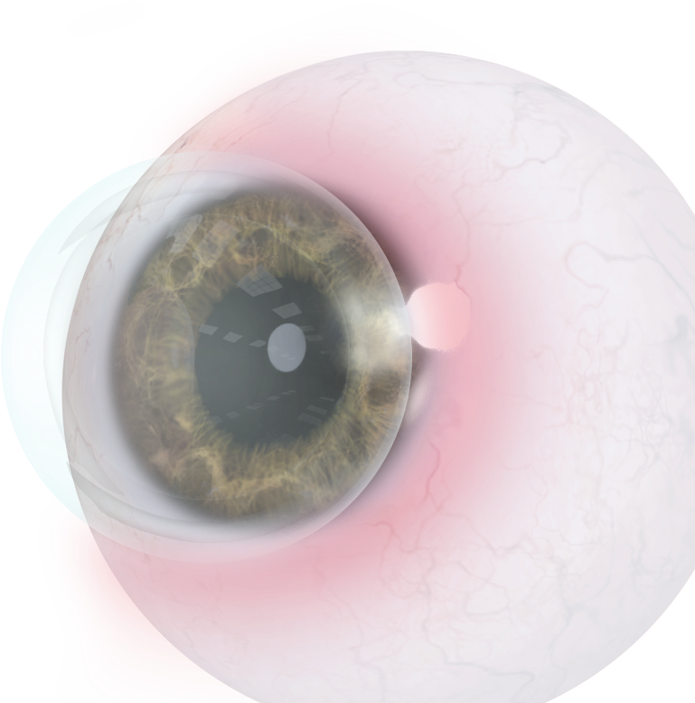 Circle (1018x840), Png Download