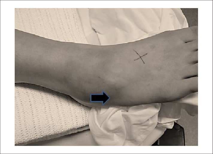 Arrow Pointer At Area Where There Is Tenderness And - Arrow (711x513), Png Download