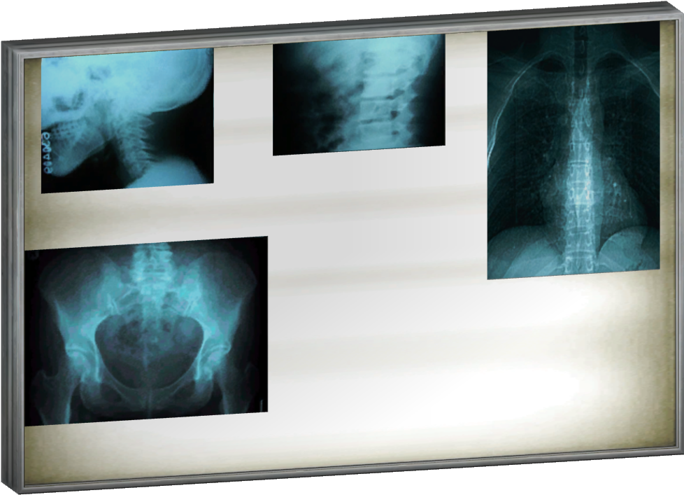 X-ray Lightbox - Light Box For X Rays (1047x750), Png Download