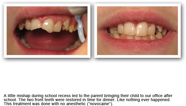 Gallery20 - Cosmetic Dentistry (663x467), Png Download