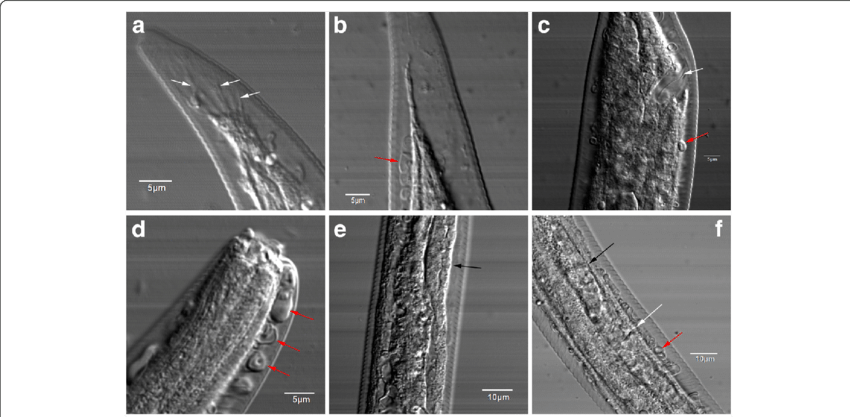 Morphological Features Of Haemonchus Contortus Larvae - Haemonchus Contortus (850x417), Png Download