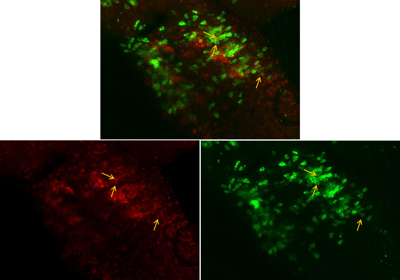 Entire Larva - - Graphic Design (1303x914), Png Download