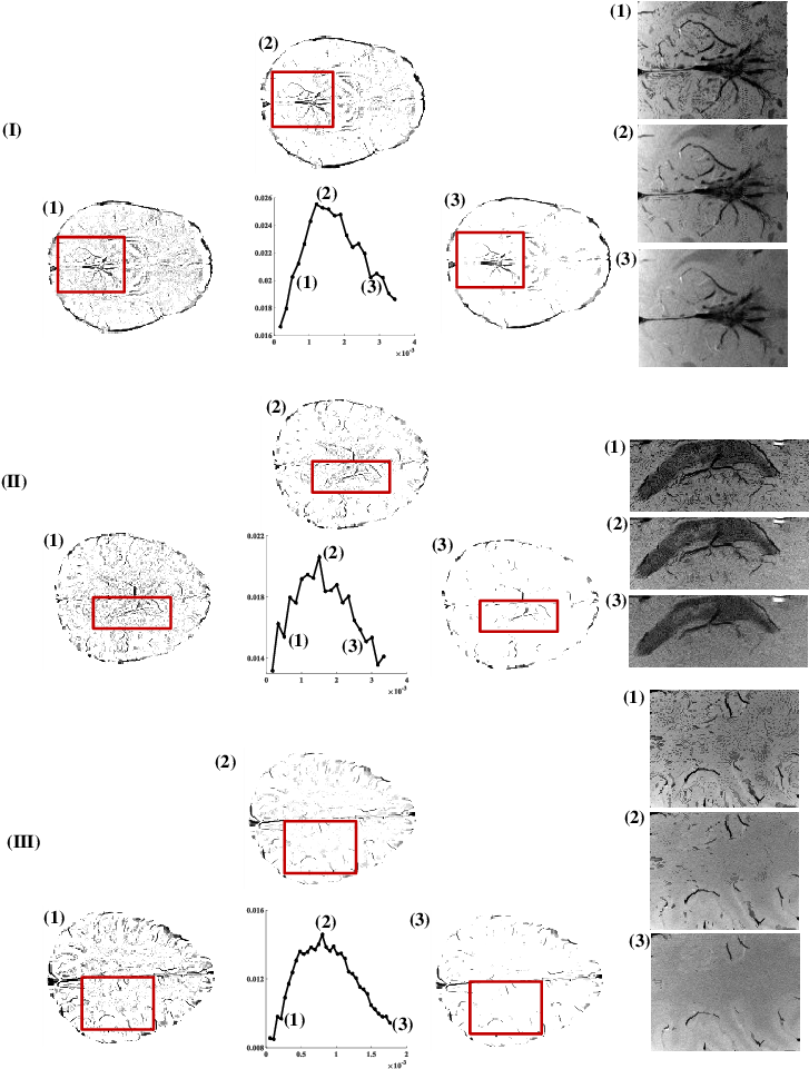 The Phase Masks Obtained Using Map Mrf Filter Is Shown - Data Set (756x970), Png Download