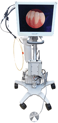 Non-surgical Treatment For Moderate To Severe Gum Disease - Periscope Periodontal (300x411), Png Download