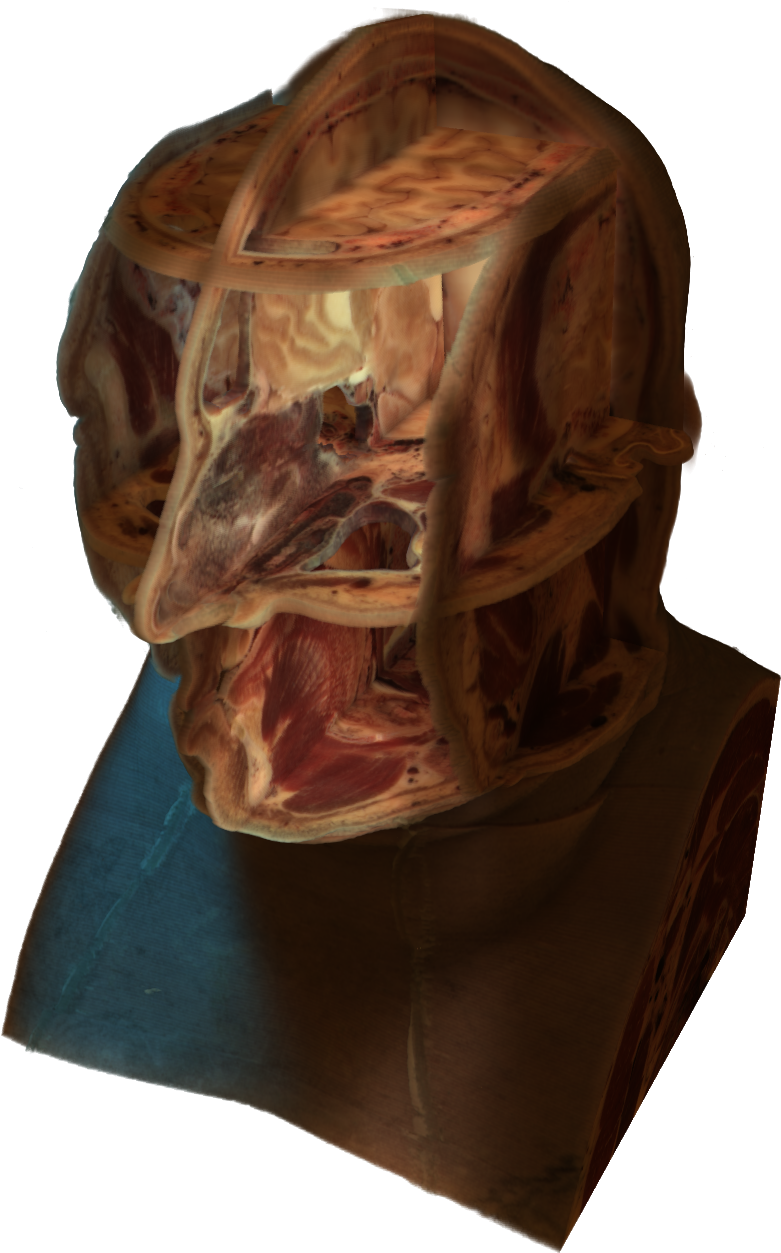 Cross-section Of A Human Head - Human Head (1659x1352), Png Download