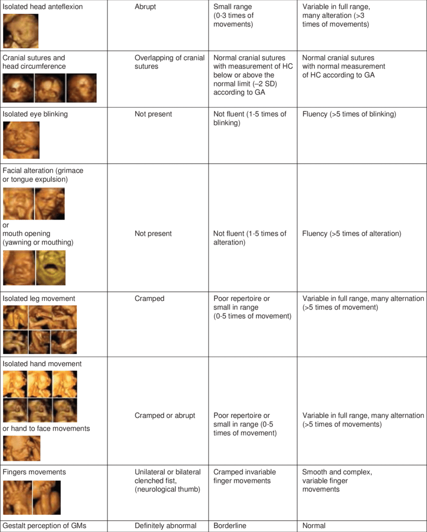 Kanet Uses A System Of 8 Fetal Structural And Behavioral - System (850x1059), Png Download