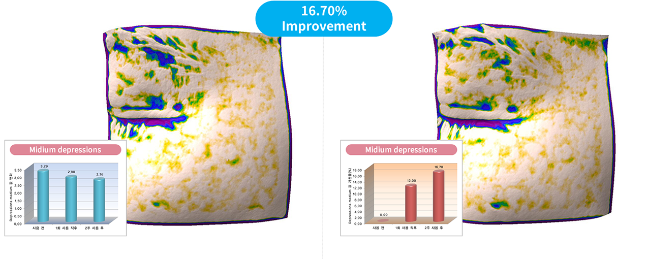 Statistical Analysis Graph For Each Subject And Analysis - Steamed Rice (1273x510), Png Download