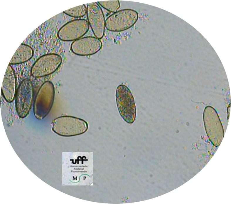 Ovo Fasciola 1 - Federal Fluminense University (787x694), Png Download