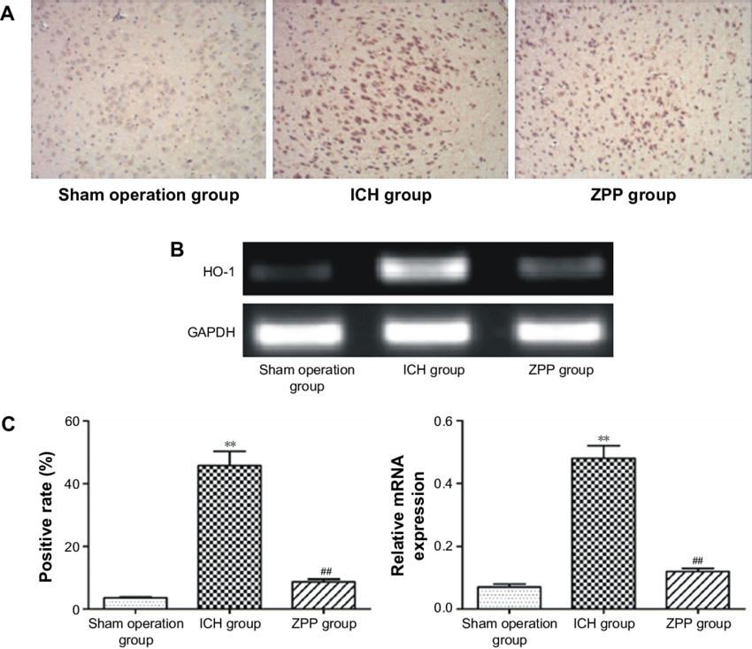 Effect Of Zpp On Brain Tissue Ho 1 Expression In Ich - Architecture (850x733), Png Download