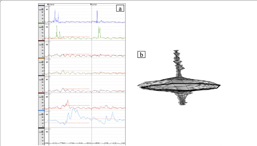 Preoperative Esophageal Manometry Findings - Sketch (850x485), Png Download