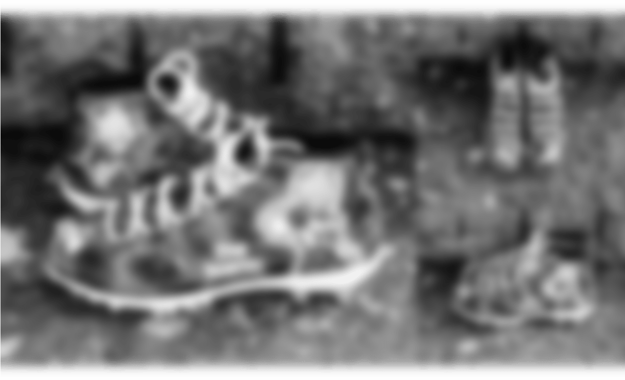 **de Branden Jackson** **cause** - Diabetes Mellitus (1280x853), Png Download