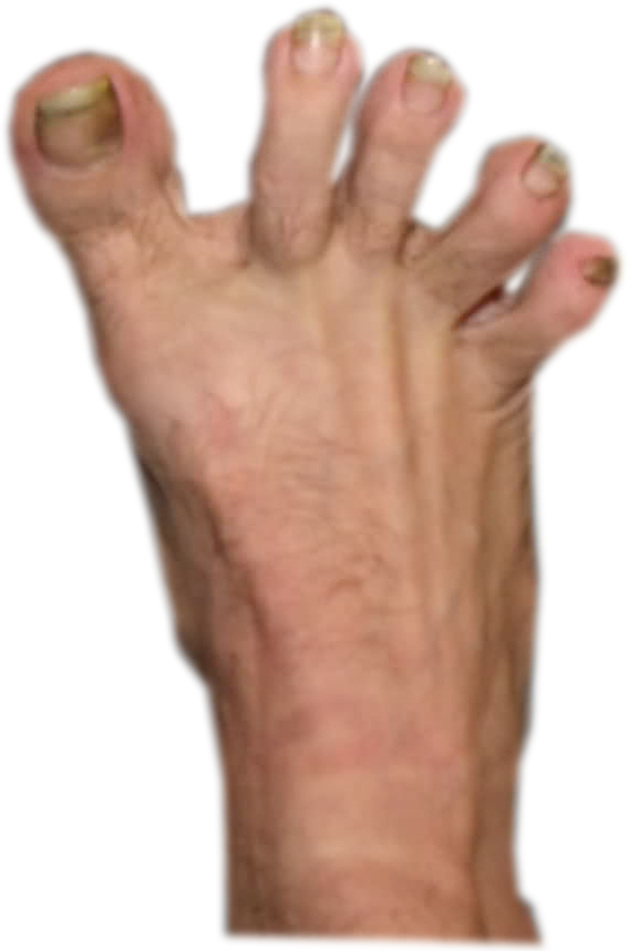 [ann] [rt2] - Pies Feos De Hombres (568x859), Png Download