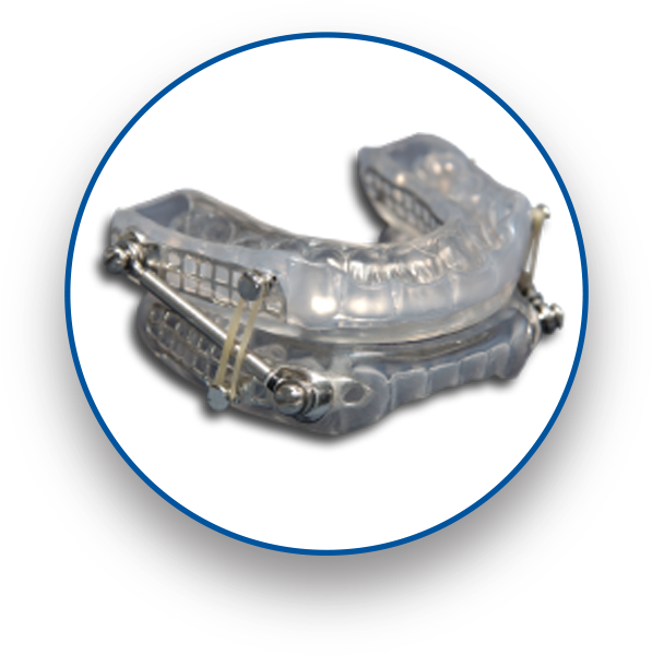Suad Oral Appliance - Bronze (600x623), Png Download