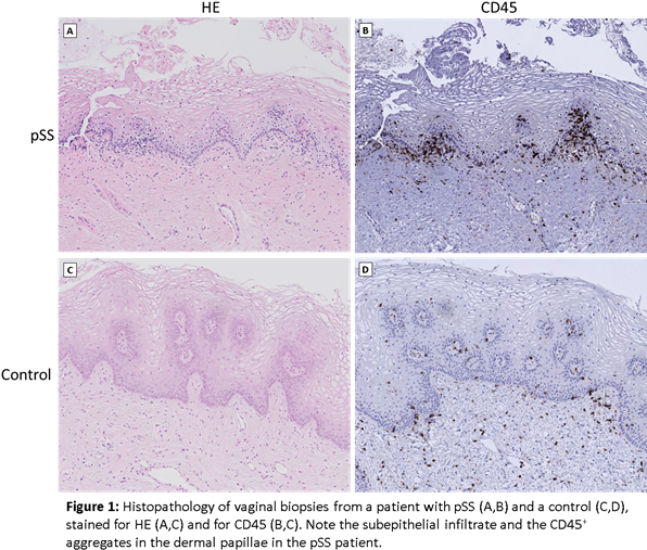 Beschrijving - Beschrijving - Beschrijving - Beschrijving - Mountain (605x524), Png Download