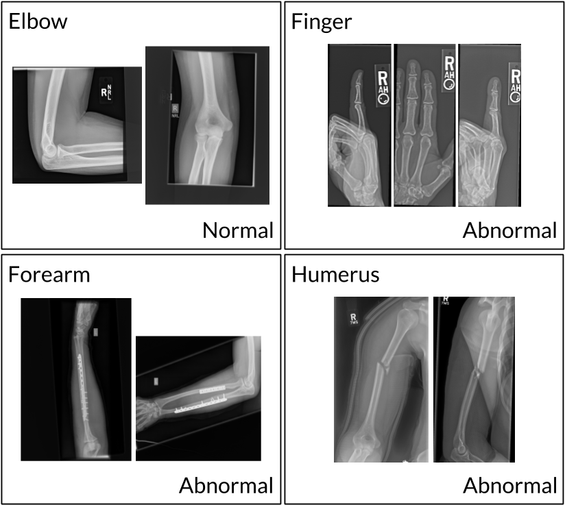 Aprendizaje Profundo Y Rayos X - X-ray (832x748), Png Download