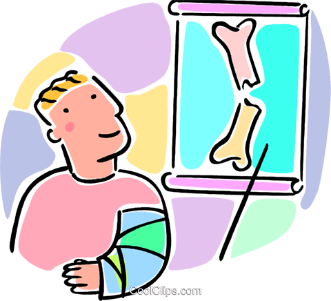 Niño Con Un Brazo Roto Y Un Rayos X Libres De Derechos - Bone Fracture (480x436), Png Download