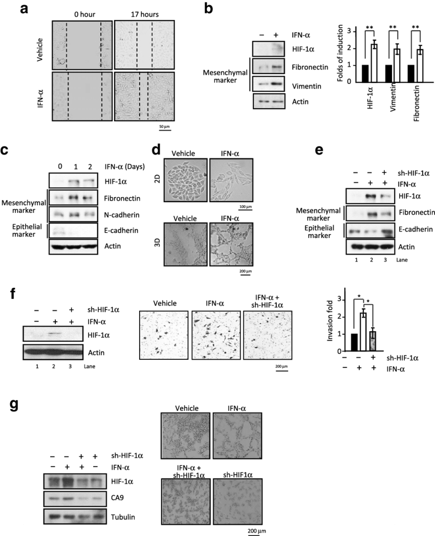 Funtional Hif 1α Expression Plays A Critical Role In - Common Fig (850x1047), Png Download