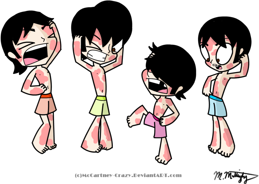 Itchy Rash Clipart - Rash Cartoon Png (900x720), Png Download