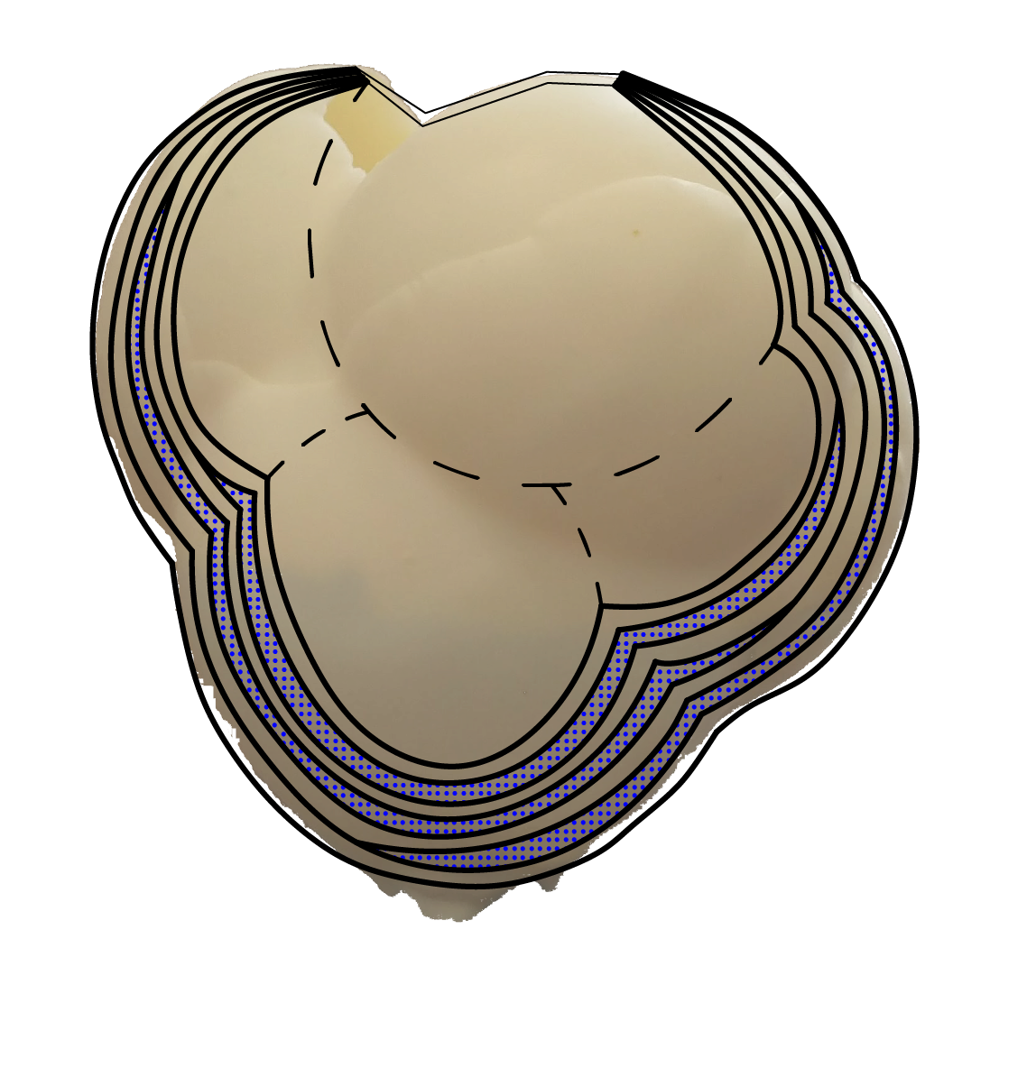 Plaster Layers Would Only Cover Half Of The Balloon, - Circle (1187x1212), Png Download