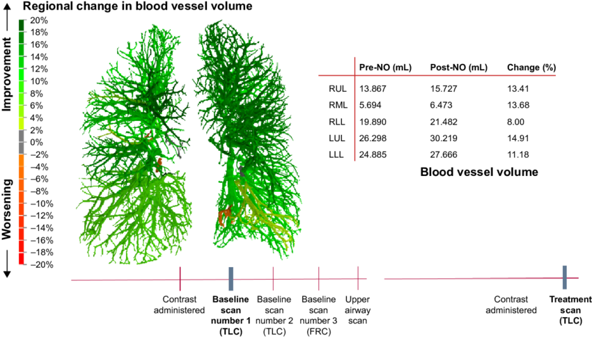 Frc, Functional Residual Capacity - Blood Vessel (850x486), Png Download