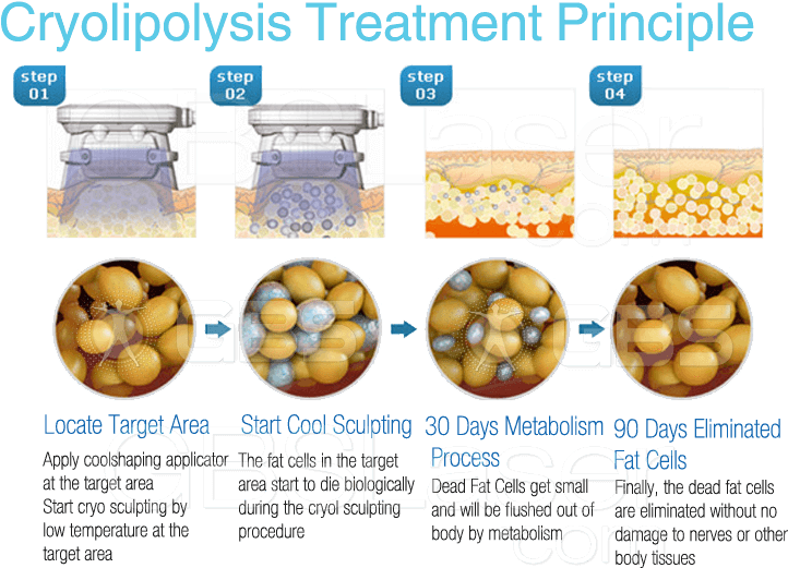 Best Coolsculption / Cryo Vacuum Cool Shape Body Slimming - Fat Cell Apoptosis (750x550), Png Download