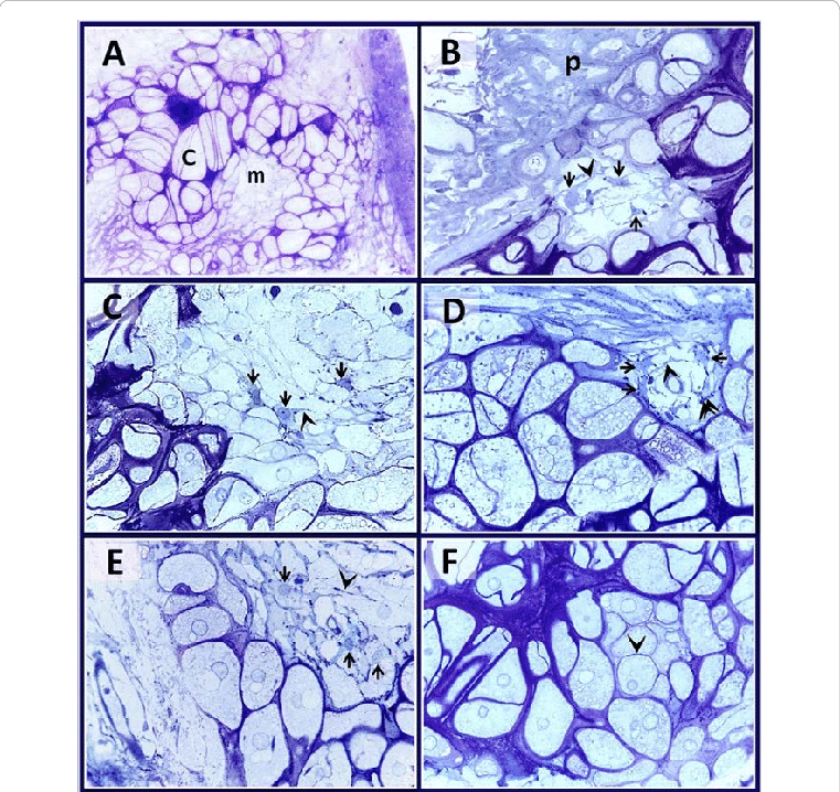 Semi-thin Sections Stained With Toluidine Blue (761x718), Png Download
