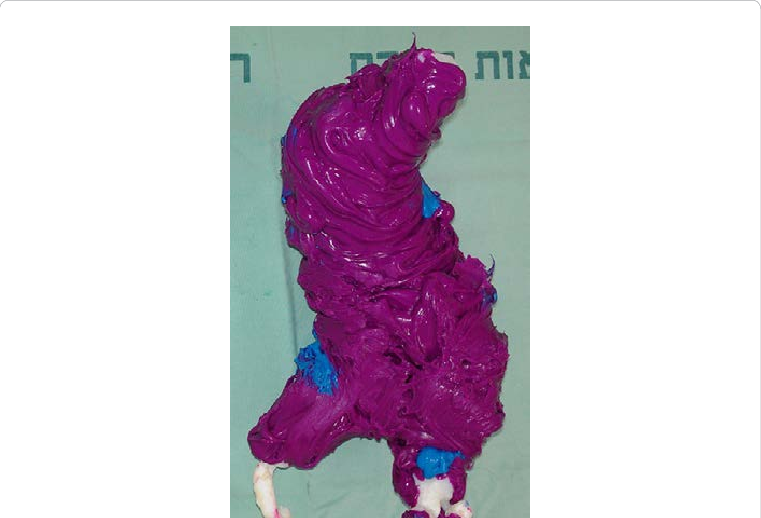 A White Silicone Shell Around A 3d Aaa Model - Silicone (761x518), Png Download