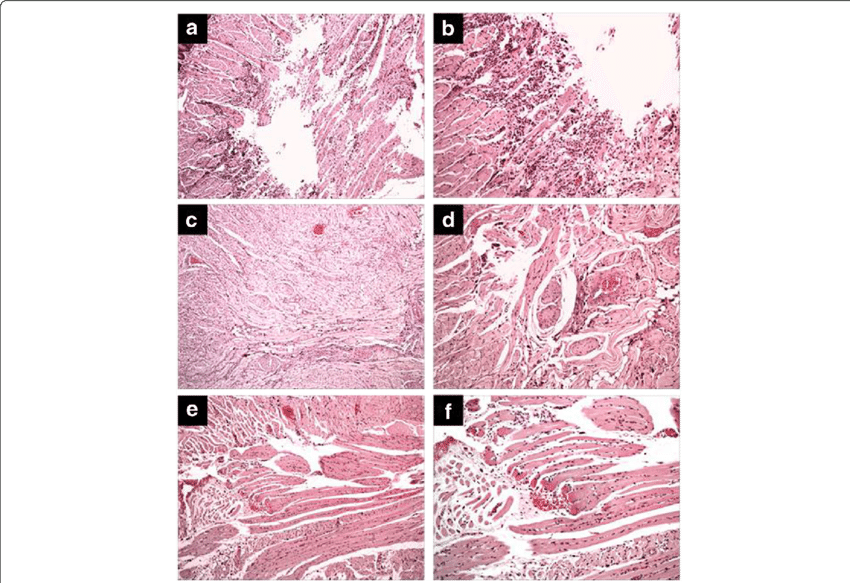 Effect Of Treatment With Copaiba Oil-resin On Transfixing - Motif (850x583), Png Download
