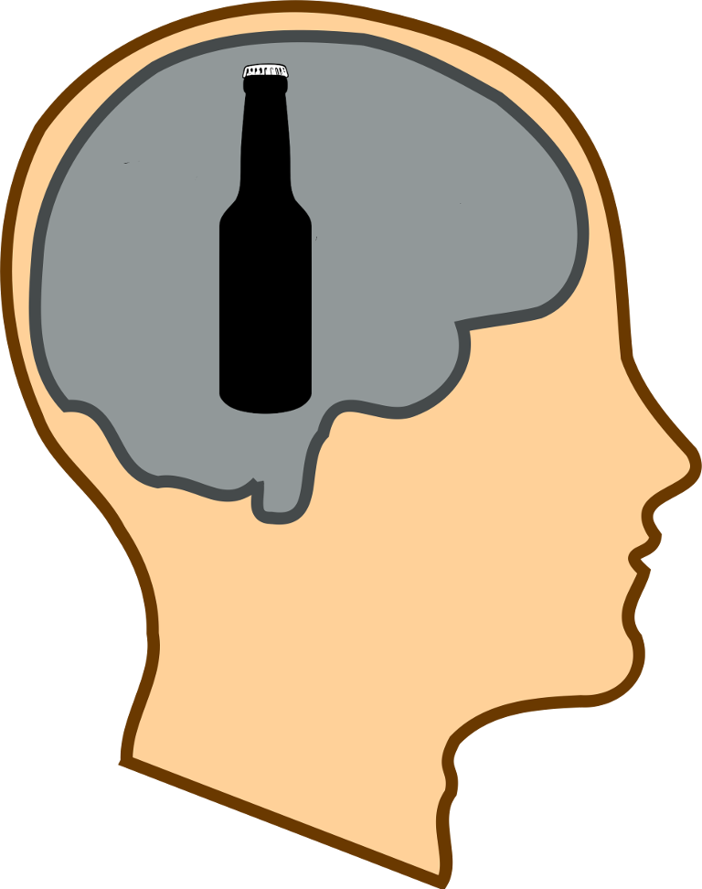 Dumb - Brain Clip Art (768x972), Png Download