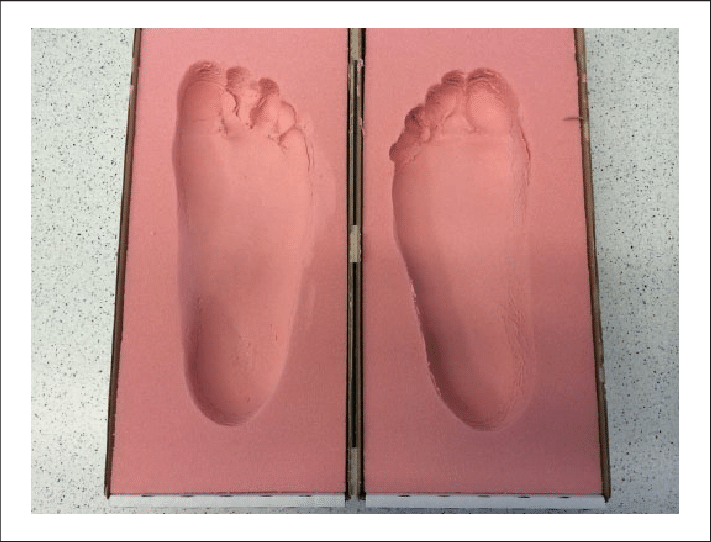 Foot Mold Taken By Foam Impression - Science (711x542), Png Download