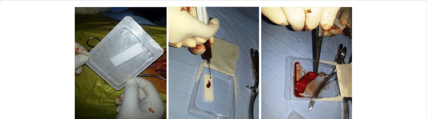 Surgical Gel Foam Saturated With Stem Cell Could Be - Stem Cell Research & Therapy (850x238), Png Download